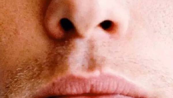 Face Reading Philtrum, Lip Crease, Vertical Groove on the Upper Lip