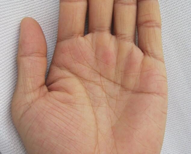 What Does Having Too Many Lines on Palm Indicate?
