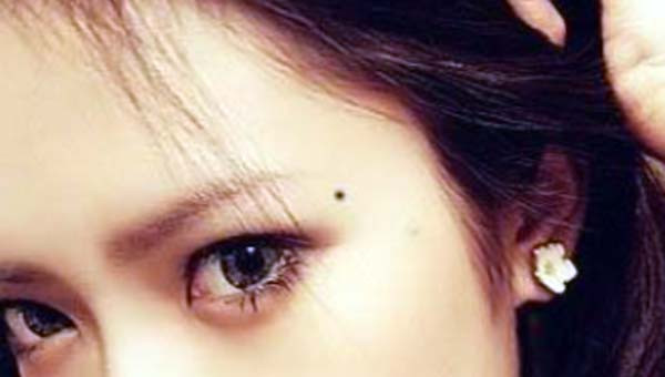 What Kind of Moles on Face Should be Removed?